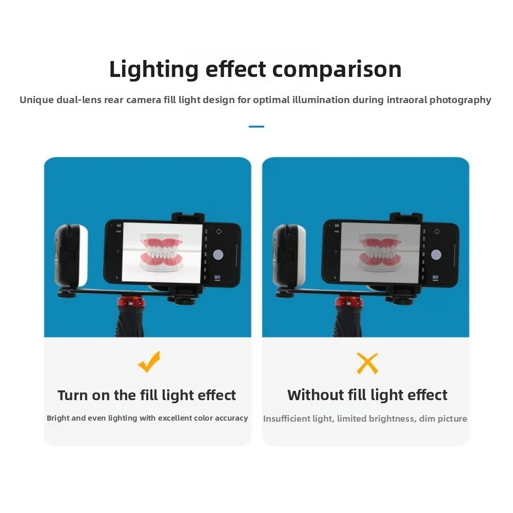 Dental Photography Light, Blue - đánh giá và giá Photography Lighting Basics